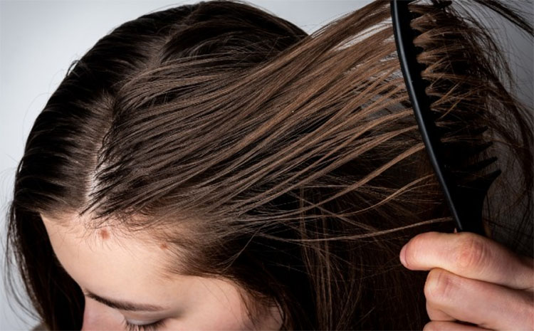 Bật mí 8 mẹo hay chữa cháy cho mái tóc bết dầu vào mùa hè